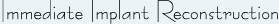Title_Immediate_Implant_Recon